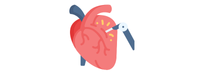 Vascular Surgery